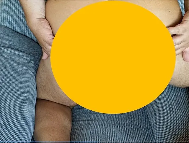 Schraubenzieher im Arsch